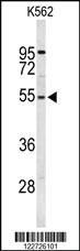 Anti-RPS6KB2 Rabbit Polyclonal Antibody