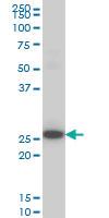 Anti-DKK1 Mouse Monoclonal Antibody [clone: 1A3]