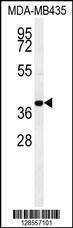 Anti-CCR8 Rabbit Polyclonal Antibody (Biotin)