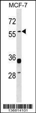 Anti-ERVW-1 Rabbit Polyclonal Antibody (APC (Allophycocyanin))