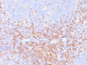 Immunohistochemical analysis of formalin-fixed, paraffin-embedded human tonsil using Anti-CD4 Antibody [CD4/3619R]