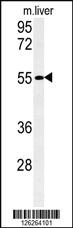 Anti-FAM151A Rabbit Polyclonal Antibody