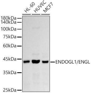 Western blot analysis of extracts of various cell lines, using Anti-ENDOGL1 / ENGL Antibody [ARC2827] (A306683) at 1:1,000 dilution. The secondary antibody was Goat Anti-Rabbit IgG H&L Antibody (HRP) at 1:10,000 dilution.