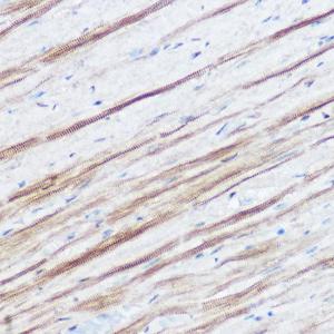 Immunohistochemistry analysis of paraffin-embedded mouse heart using Anti-Monoacylglycerol Lipase/MGL Antibody (A12000) at a dilution of 1:50 (40X lens). Perform high pressure antigen retrieval with 10 mM citrate buffer pH 6.0 before commencing with IHC staining protocol