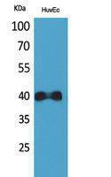 Antibody anti-CXCR2 A101127-100 100 µg