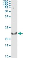 Anti-TNFSF14 Antibody Pair