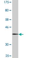 Anti-DPYSL2 Mouse Monoclonal Antibody [clone: 1F11]