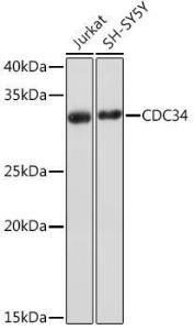 Western blot analysis of extracts of various cell lines, using Anti-Cdc34 Antibody [ARC1742] (A306686) at 1:1,000 dilution. The secondary antibody was Goat Anti-Rabbit IgG H&L Antibody (HRP) at 1:10,000 dilution.