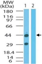 Anti-FNTA Rabbit Polyclonal Antibody