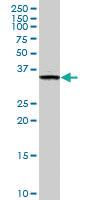 Anti-FN3K Mouse Monoclonal Antibody [clone: 4F2]