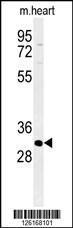 Anti-ATP4B Rabbit Polyclonal Antibody (FITC (Fluorescein Isothiocyanate))