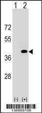 Anti-PPP1CC Rabbit Polyclonal Antibody (AP (Alkaline Phosphatase))