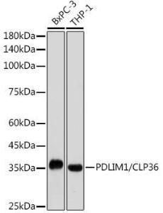 Anti-PDLIM1/CLP36 antibody