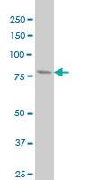 Anti-PFKL Mouse Monoclonal Antibody [clone: 2A9]