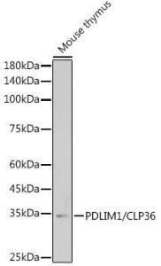 Anti-PDLIM1/CLP36 antibody