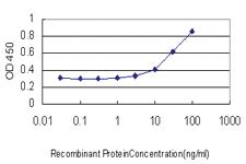 Anti-DKK1 Mouse Monoclonal Antibody [clone: 1A3]