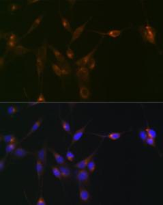 Anti-PDLIM1/CLP36 antibody