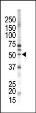 Anti-PACSIN1 Rabbit Polyclonal Antibody (AP (Alkaline Phosphatase))