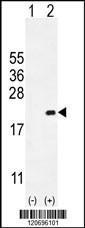 Anti-CDKN2C Rabbit Polyclonal Antibody (HRP (Horseradish Peroxidase))