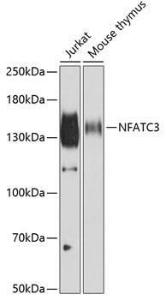 Anti-NFAT4/NF-ATc3 antibody