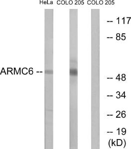 Anti-ARMC6 antibody