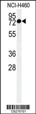 Anti-CCDC62 Rabbit Polyclonal Antibody