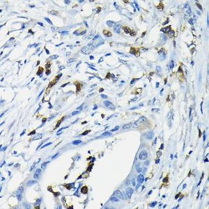 Anti-NFAT4/NF-ATc3 antibody