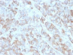 Anti-BCMA antibody