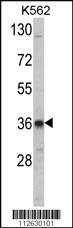 Anti-MATK Rabbit Polyclonal Antibody