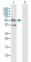 Anti-IL3RA Mouse Polyclonal Antibody