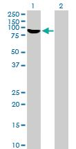 Anti-RBM5 Mouse Polyclonal Antibody