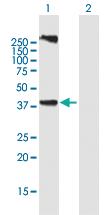 Anti-CERS3 Mouse Polyclonal Antibody