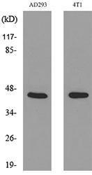 Western blot analysis of lysate from AD293, 4T1 cells using Anti-TNNT2 Antibody