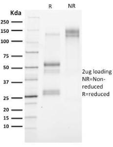 SDS-PAGE analysis of Anti-Cytokeratin 3 Antibody [KRT3/2130] under non-reduced and reduced conditions; showing intact IgG and intact heavy and light chains, respectively. SDS-PAGE analysis confirms the integrity and purity of the Antibody