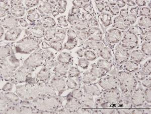 Anti-RBM5 Mouse Polyclonal Antibody