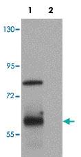 Anti-SPTLC1 Rabbit Polyclonal Antibody