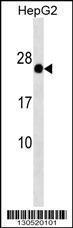 Anti-GAGE12F Rabbit Polyclonal Antibody (HRP (Horseradish Peroxidase))