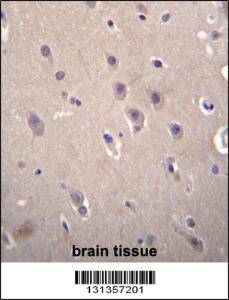 Anti-DLL3 Rabbit Polyclonal Antibody (AP (Alkaline Phosphatase))