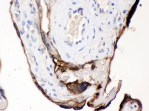 Anti-CDCP1 Antibody