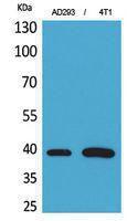 Western blot analysis of AD293, 4T1 cells using Anti-TNNT2 Antibody