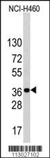 Anti-LDLRAP1 Rabbit Polyclonal Antibody