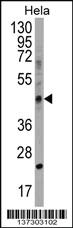 Anti-CHID1 Rabbit Polyclonal Antibody