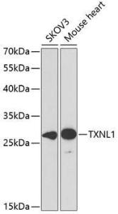 Western blot analysis of extracts of various cell lines, using Anti-TXNL1 Antibody (A307964) at 1:1,000 dilution. The secondary antibody was Goat Anti-Rabbit IgG H&L Antibody (HRP) at 1:10,000 dilution.