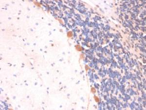 Immunohistochemical analysis of formalin-fixed, paraffin-embedded rat brain using Anti-ARF1 Antibody [ARF1/2117]