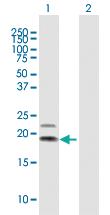 Anti-IL4 Mouse Polyclonal Antibody