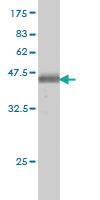 Anti-ATP2C1 Mouse Monoclonal Antibody [clone: 2G1]