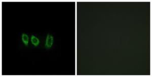 Antibody anti-CSTL1 100 µg