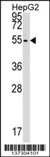 Anti-CLP1 Rabbit Polyclonal Antibody