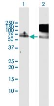 Anti-RBM5 Rabbit Polyclonal Antibody