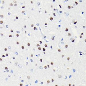 Anti-BRG1 Rabbit Monoclonal Antibody [clone: ARC0035]